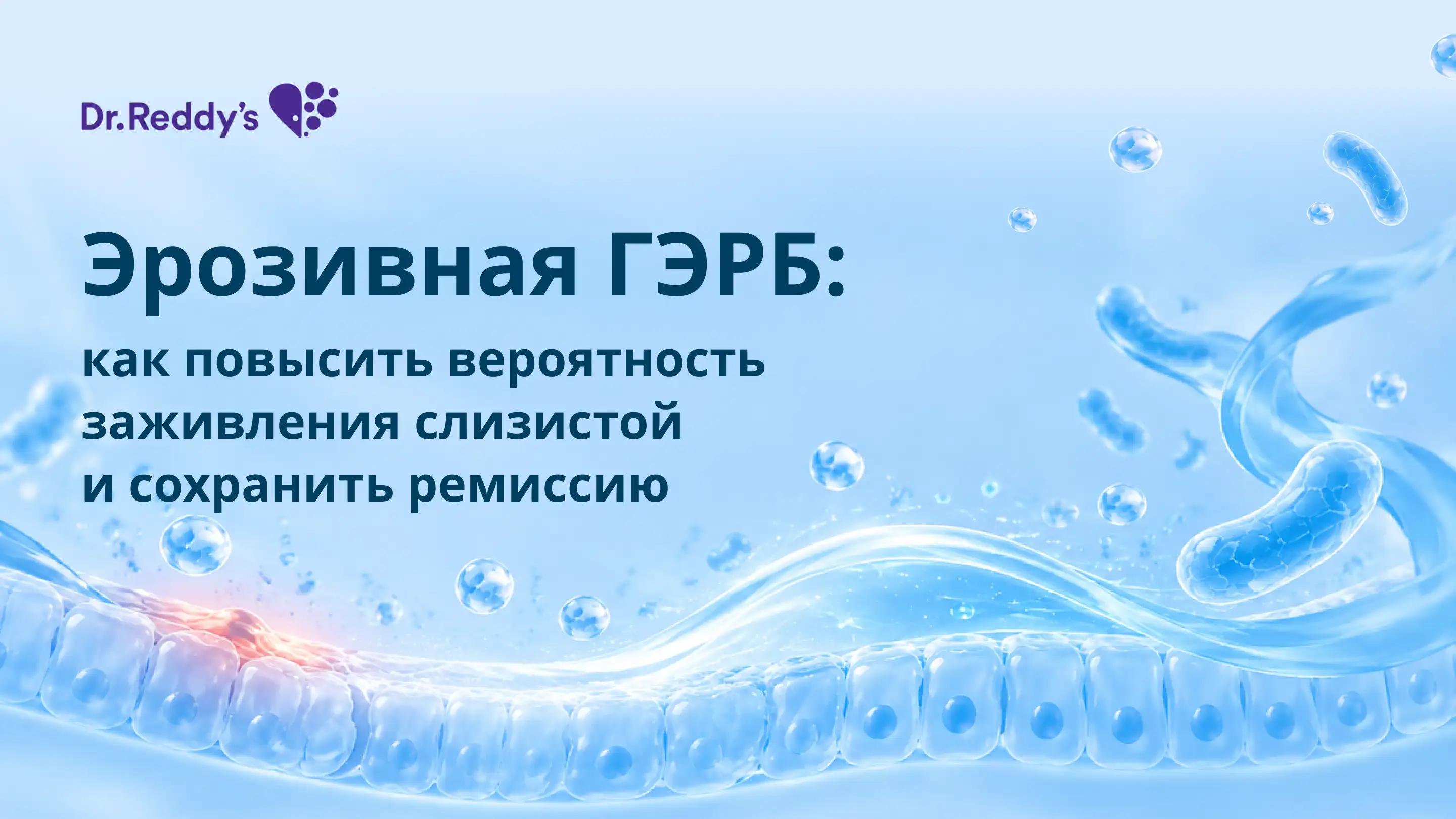 Эрозивная ГЭРБ: как повысить вероятность заживления слизистой и сохранить ремиссию