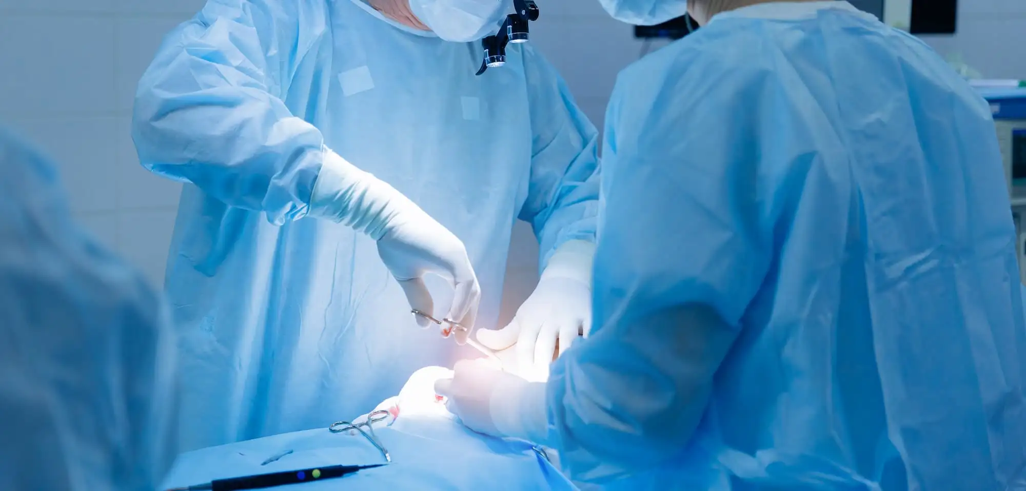 Total pancreatectomy