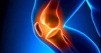 Эффект от применения снижающих нагрузку на коленный сустав ортезов на суставную щель медиального отдела при ходьбе у пациентов с остеоартрозом коленного сустава