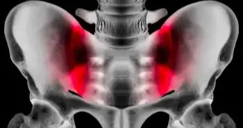 Хирургическое лечение синдрома бедренно-вертлужного соударения отрицательно влияет на степень тяжести остеоартроза по данным рентгенографического исследования