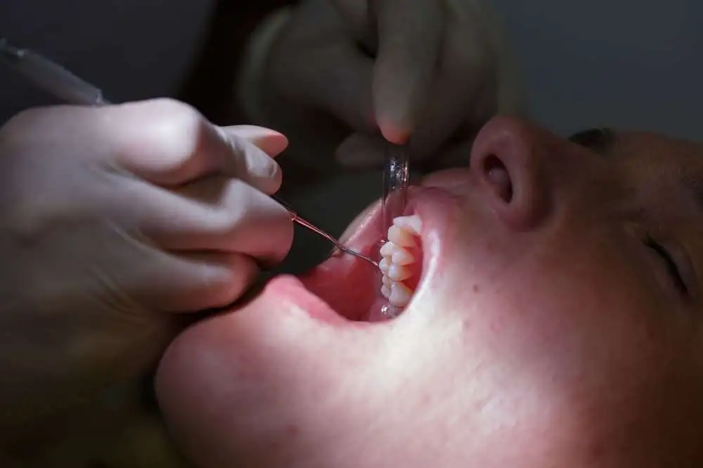 Восстановительное лечение пародонта может обеспечить длительное снижение количества дефектов и сохранение зубов