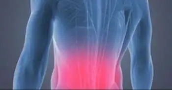 Мифы о боли в спине могут приводить к усилению неприятных ощущений и неэффективности лечения