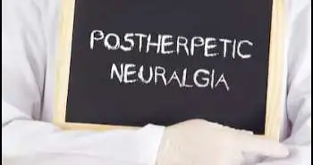 Price of pain: population-based cohort burden of disease analysis of medication cost of herpes zoster and postherpetic neuralgia