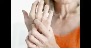 Depiction of hand forces during a joint-protection strategy for women suffering from hand osteoarthritis