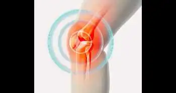 Лечение с помощью электромагнитного поля может избавить от симптомов остеоартроза коленного сустава