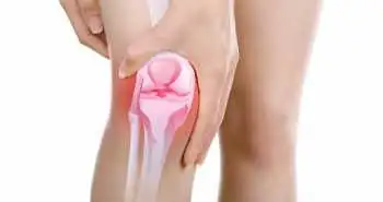 Установлена эффективность применения терапии ран отрицательным давлением после тотального эндопротезирования коленного сустава