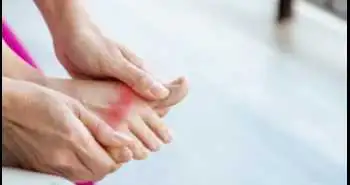Канакинумаб снижает болезненность и отечность суставов и обеспечивает облегчение боли у пациентов с обострениями подагры