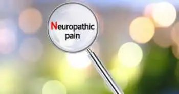 Лечение и факторы риска, связанные с хронической нейропатической болью после ожогов кисти