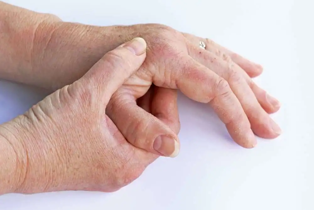 Упадацитиниб: повышение качества жизни пациентов с ревматоидным артритом