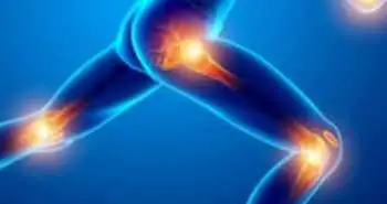 Сравнение эффективности нимесулида и диклофенака в терапии остеоартроза тазобедренного и коленного суставов