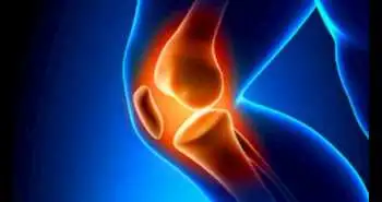 Згідно з результатами дослідження, застосування стронцію ранелату є новим методом лікування первинного остеоартрозу колінного суглоба