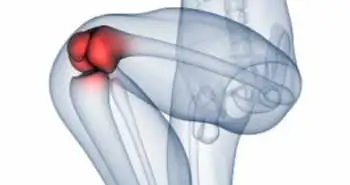 Подкожное введение танезумаба способствует облегчению боли при остеоартрозе тазобедренного и коленного суставов