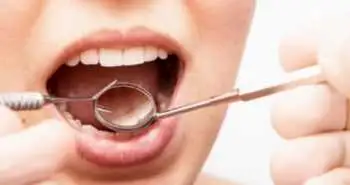 Эффективность полоскания полости рта растворами с хлоргексидином, антиоксидантами и гиалуроновой кислотой для лечения гингивита, вызванного бактериями зубного налета