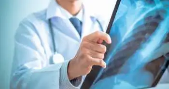 Study evaluated the diagnostic performance of Chest CT for SARS-CoV-2 Infection in Individuals with or without COVID-19 Symptoms