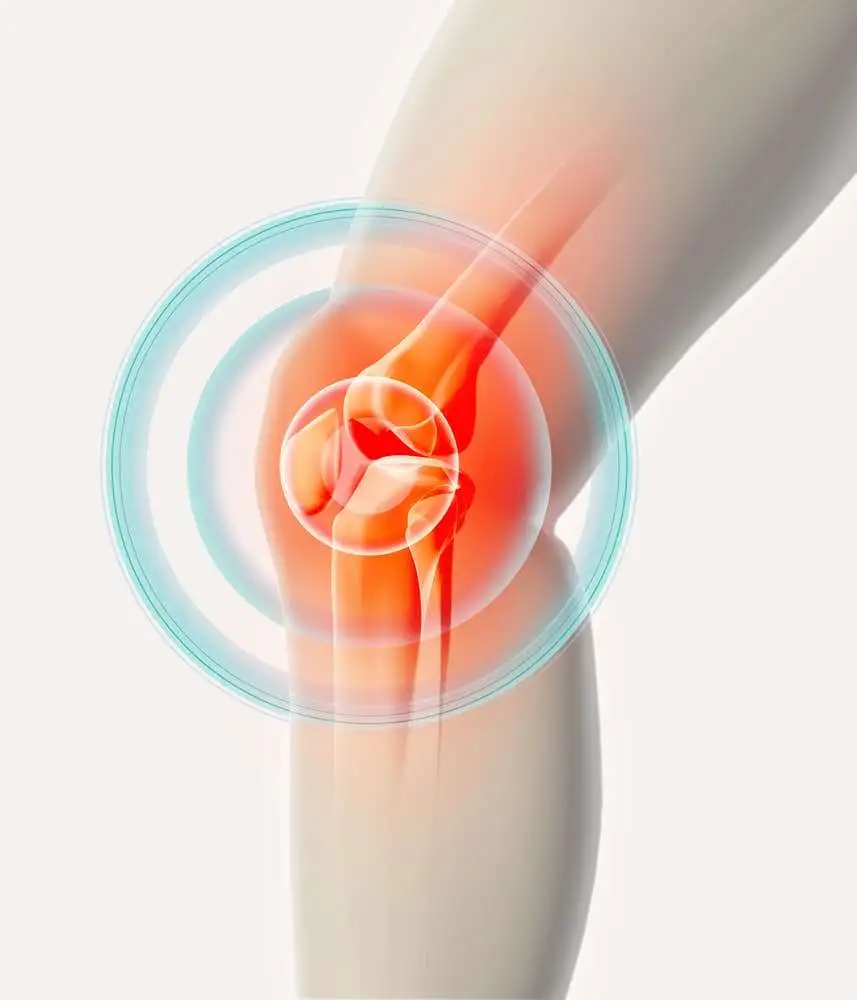 Эффективность внутрисуставных инъекций бикарбоната натрия и глюконата кальция в лечении остеоартрита коленного сустава: двойное слепое рандомизированное клиническое исследование.