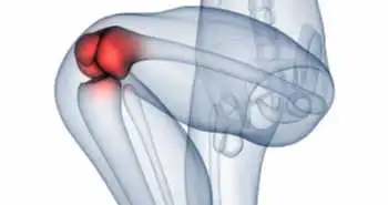Связь между назначением β-блокаторов и обращением за первичной медицинской помощью по поводу остеоартроза коленного сустава и боли в коленном суставе