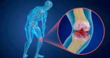 Сравнение эффективности блокады подколенного нерва при остеоартрозе коленного сустава с использованием классических анатомических мишеней и пересмотренных мишеней