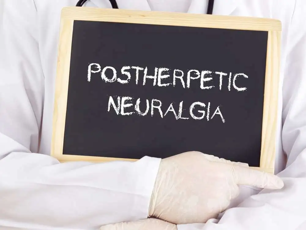 Guidelines on pain management in post-herpetic neuralgia