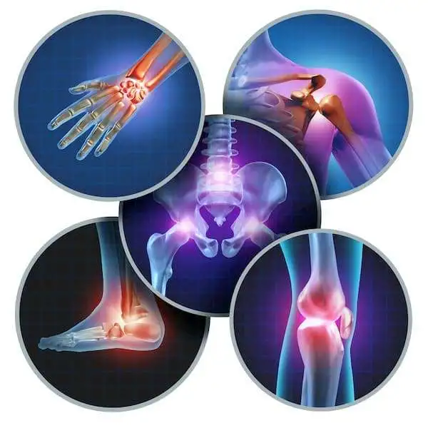 Федеральные клинические рекомендации по диагностике и лечению остеоартроза 2013 года