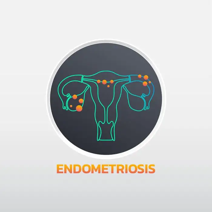 adenomyosis