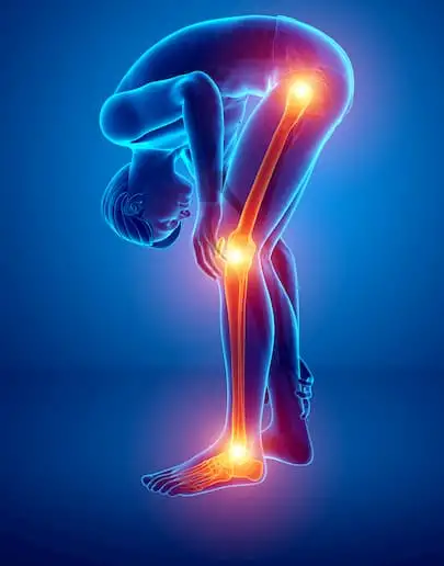 knee.osteoarthritis