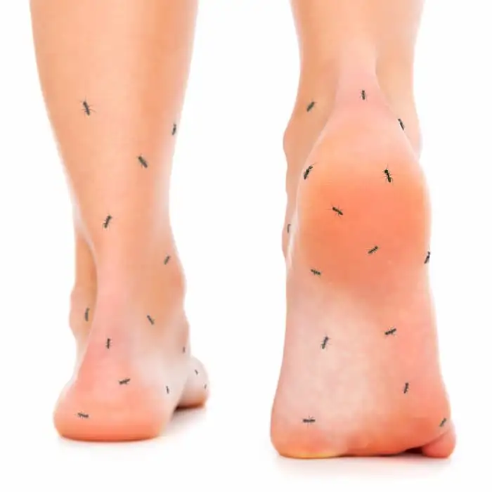 Diabetic Neuropathy