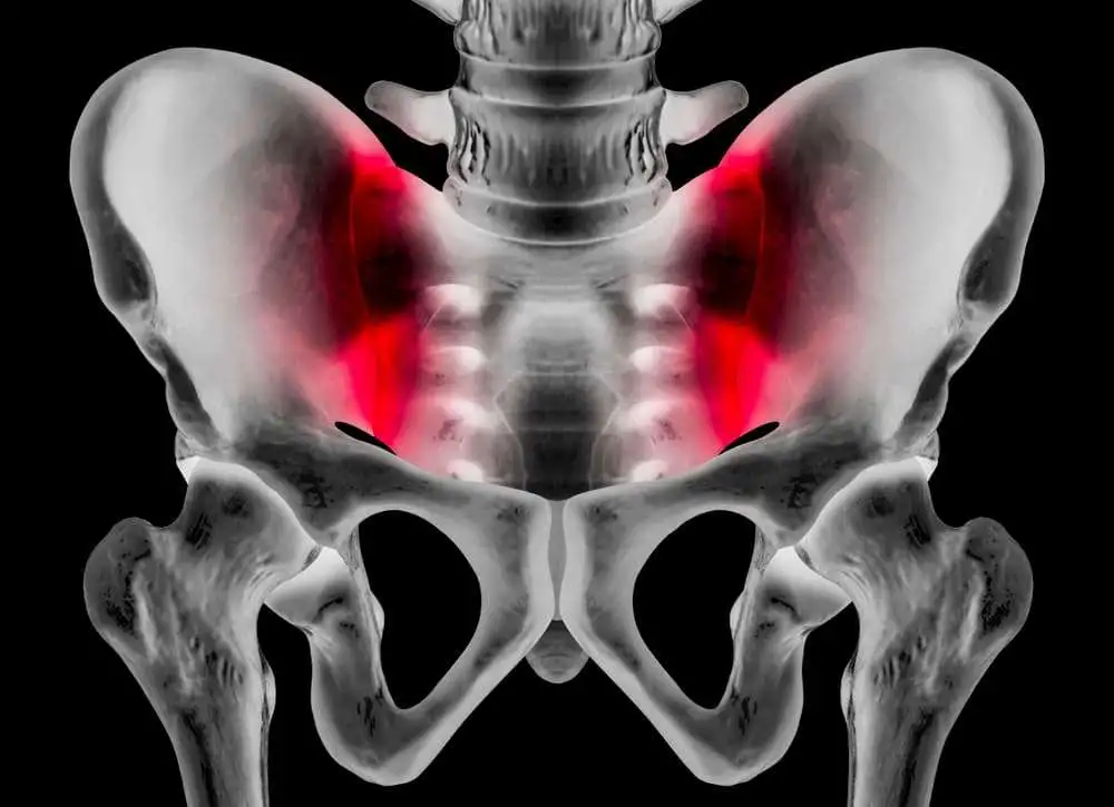 Случай проявления двухсторонней боли в тазобедренном суставе при остеоартрите и сердечно-сосудистых заболеваниях