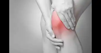 Рандомизированное клиническое исследование по оценке эффективности применения стелек «боковой клин» при сопровождающемся болью остеоартрозе медиальной области коленного сустава