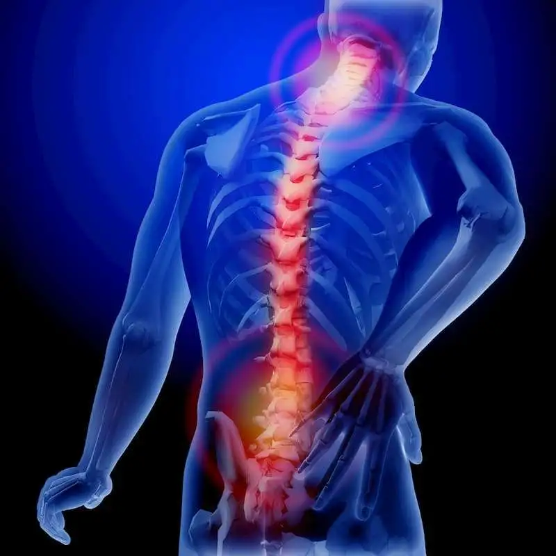 Только у 30% пациентов с болью в спине развивается спондилоартрит