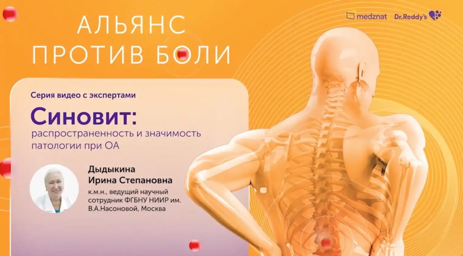 Синовит и физические нагрузки. Что такое синовит и как он лечится? Упражнения и физические нагрузки при ВСД Презентация "Основы общей и специальной физической подготовки.