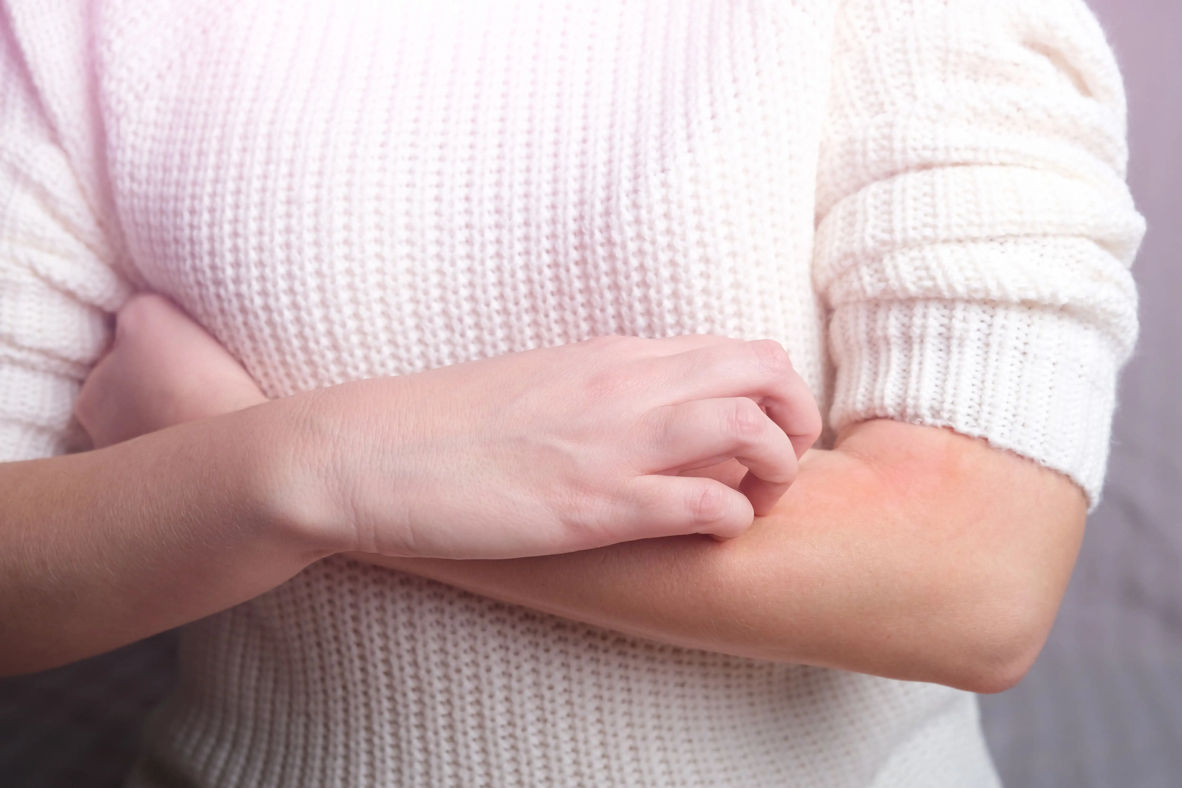 Chronic urticaria management