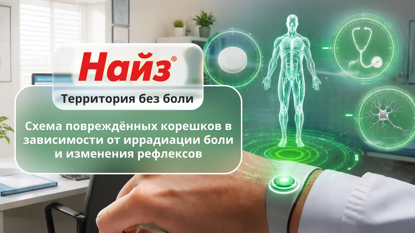 Схема повреждённых корешков в зависимости от иррадиации боли и изменения рефлексов