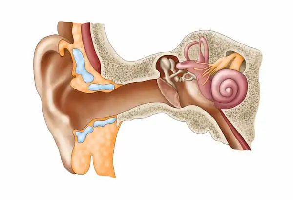 Otitis media with effusion